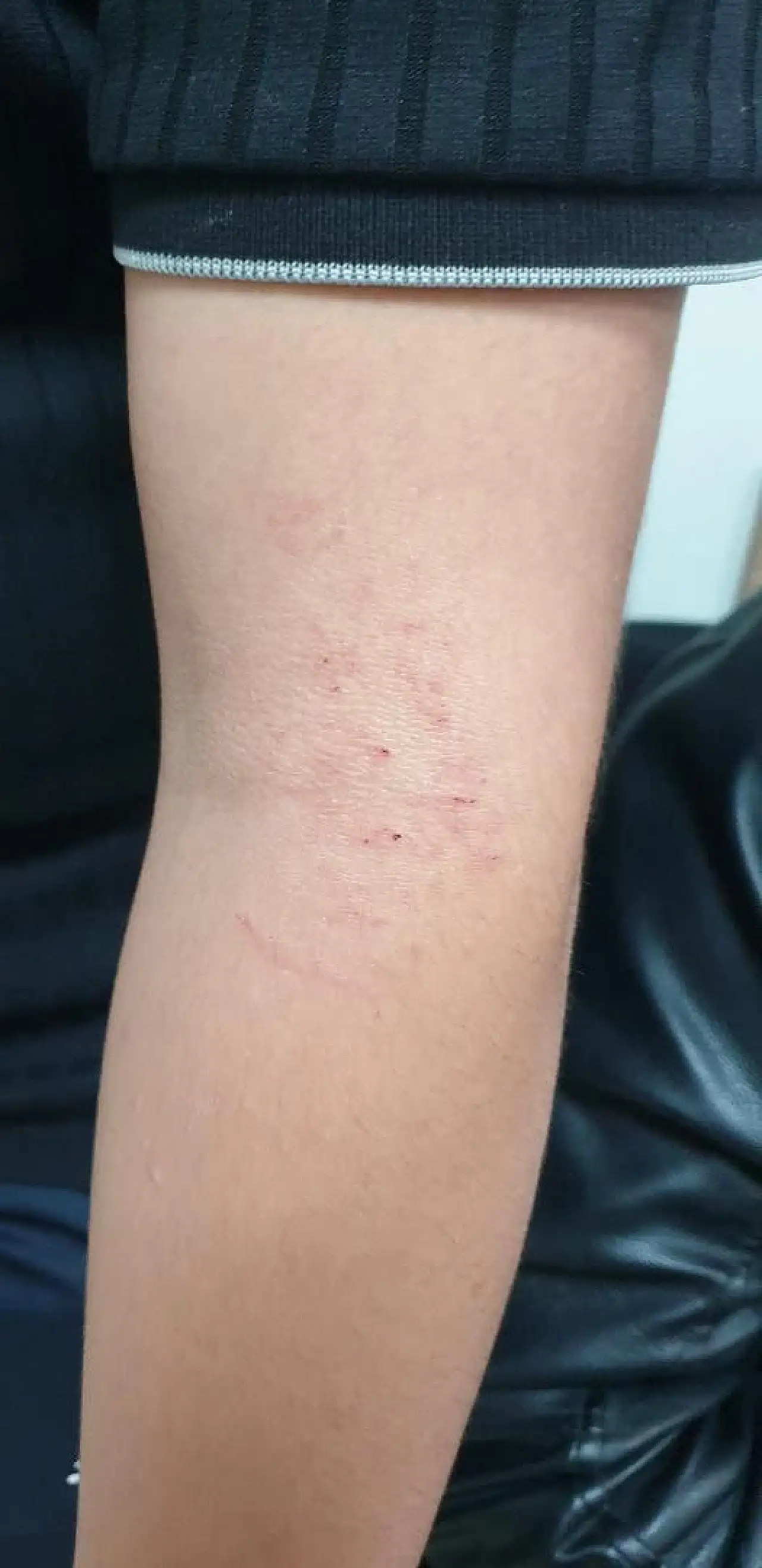 Kayseri'de kadına taşlı saldırı