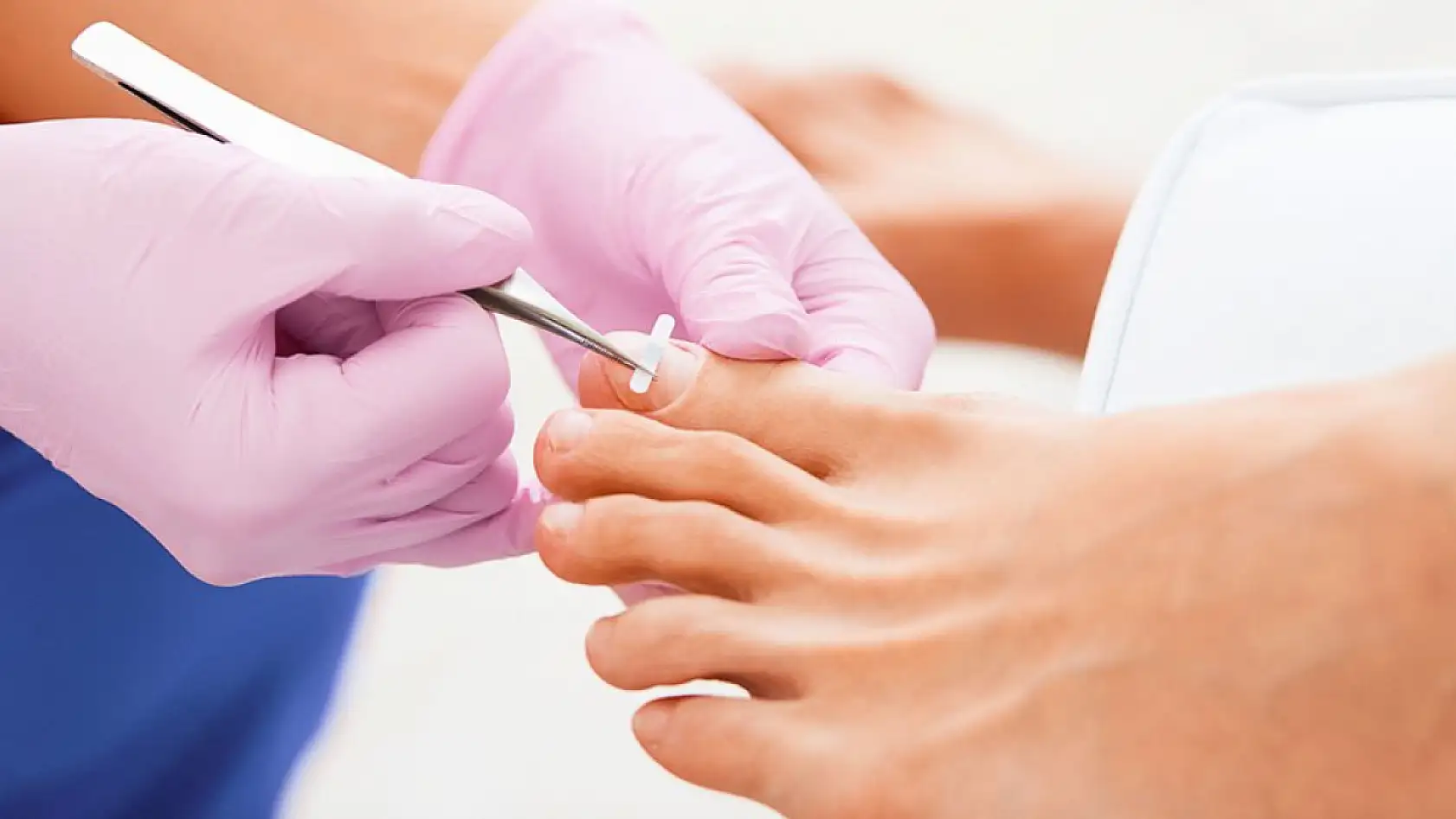 Tırnak batması neden olur? İşte batmayı engellemek için alınacak basit ve kolay önlemler