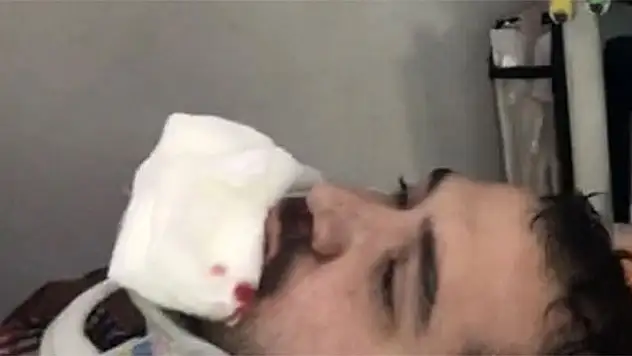 AK Parti seçim aracının şoförü darp edildi