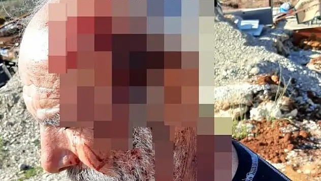 ARAZİ KAVGASINDA YAŞLI ADAMI DARP ETTİLER