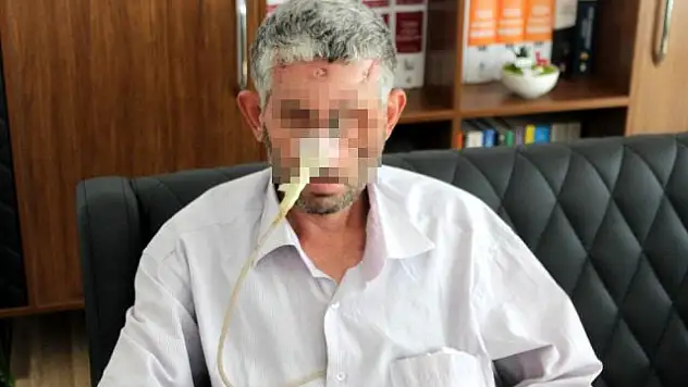 DİŞİNİ ÇEKTİRMEK İÇİN HASTANEYE GİTTİ GÖZÜNDEN OLDU