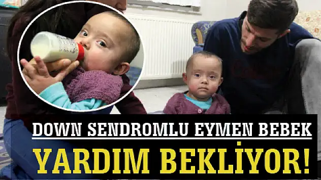 DOWN SENDROMLU EYMEN BEBEK YARDIM BEKLİYOR!