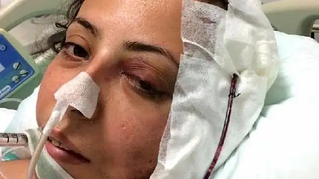 ESKİ KARISINI KIZININ YANINDA DARP EDİP BAŞINDAN VURDU