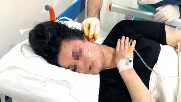 GENÇ KADINI ORMANA KAÇIRIP İŞKENCE ETTİLER!
