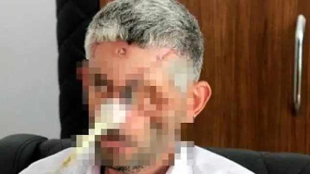 Hatay Valiliği'nden Gözünü Kaybeden Adama Yalanlama