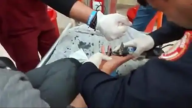 İtfaiyeden yüzük kesme operasyonu