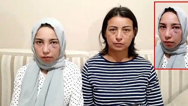 KÖPEĞİ HAVLIYOR DİYE ACIMASIZCA DARP ETTİLER