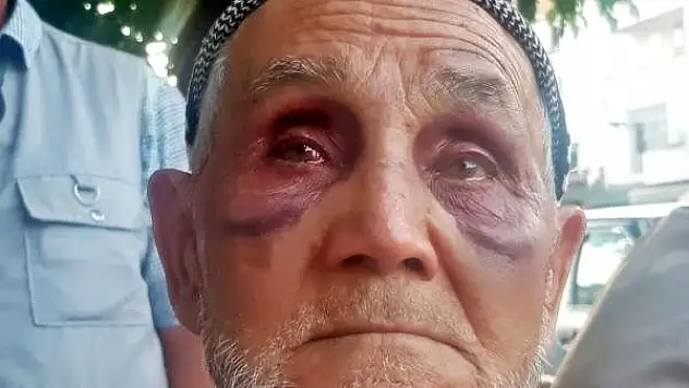 OĞLUNDAN KURTULMAK İÇİN CAMDAN ATLADI