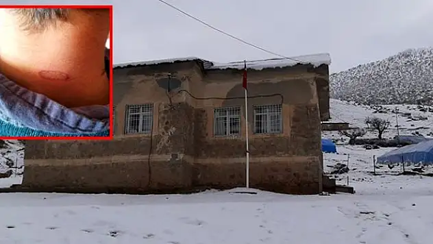 ÖĞRENCİLERİN VÜCUDUNA SICAK SOBA MAŞASI DEĞDİREN ÖĞRETMEN AÇIĞA ALINDI