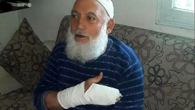 PAZARLIK ETTİĞİ ADAMIN PARMAKLARINI KIRDI