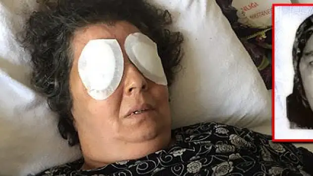 ŞİZOFRENİ HASTASI KADIN, ODA ARKADAŞININ GÖZLERİNİ OYDU!