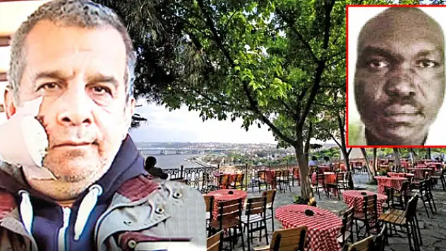 Sudanlı Bürokrat, Türk Arkadaşının Yanağını Kopardı