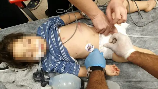 ÜVEY ANNENİN KOMAYA SOKTUĞU KÜÇÜK KIZ EMİN ELLERDE