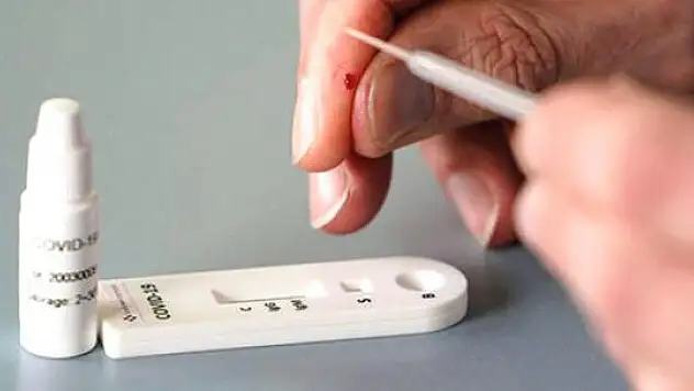VAKA ARTIŞININ DEVAM ETTİĞİ 13 İLİMİZDE ANTİKOR TESTİ YAPILACAK