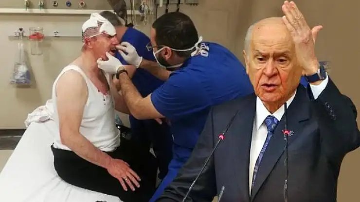 BAHÇELİ'DEN ÖZDAĞ'A YAPILAN SALDIRIYLA İLGİLİ AÇIKLAMA: KİM NEYE MARUZ KALMIŞSA ÖNCE ETRAFINA BAKSIN