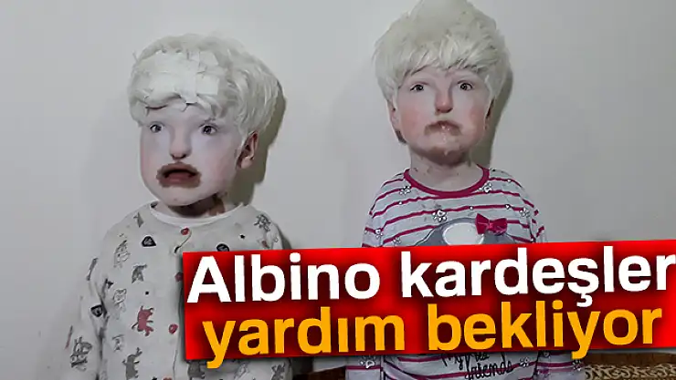 Albino kardeşler yardım bekliyor