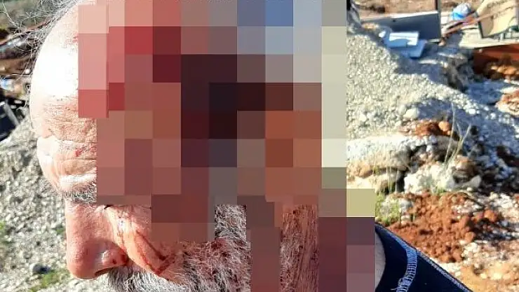 ARAZİ KAVGASINDA YAŞLI ADAMI DARP ETTİLER