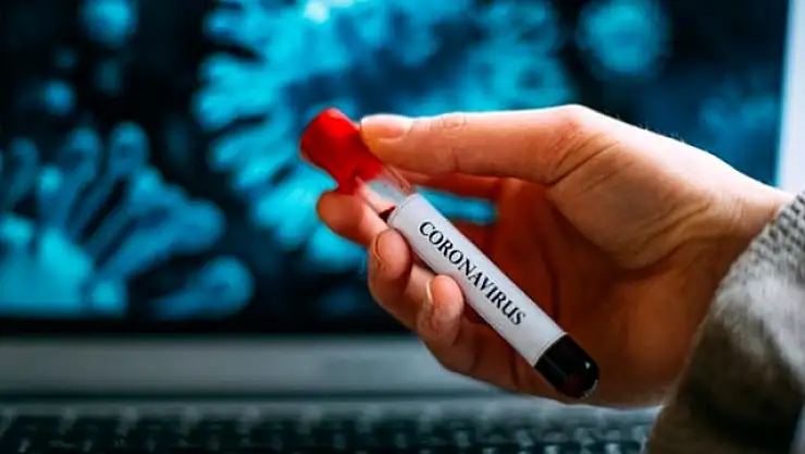 AVUSTRALYALI BİLİM İNSANLARI KORONAVİRÜSÜN TEDAVİSİNİ BULDU!