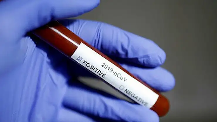 BAKAN KOCA DUYURDU! TÜRKİYE'DE İKİNCİ KORONAVİRÜS VAKASI GÖRÜLDÜ