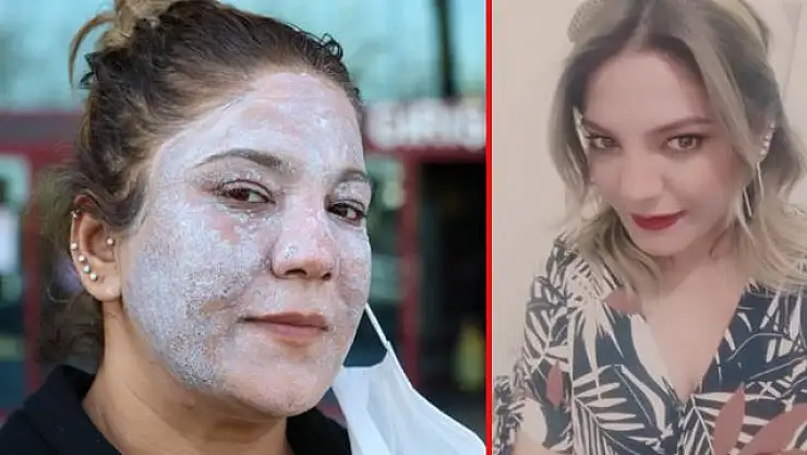 'CİLDİN BEBEK GİBİ OLACAK' DENİLEN KADIN KABUSU YAŞIYOR