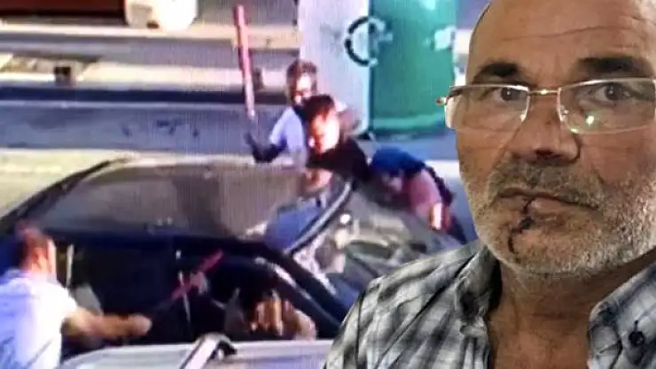 DAMAT, KAYINPEDERİNİN DUDAĞINI ISIRARAK PARÇALADI!