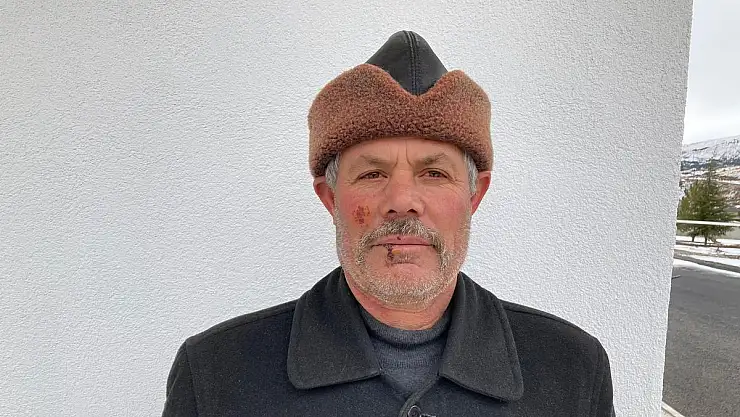 DOMUZU TELEFONUYLA ÇEKERKEN SALDIRIYA UĞRADI