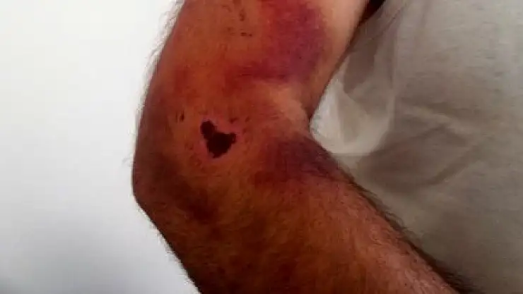 ENGELLİ KIZ VE BABASINI OY VERMEDİĞİ İÇİN DARP ETTİLER