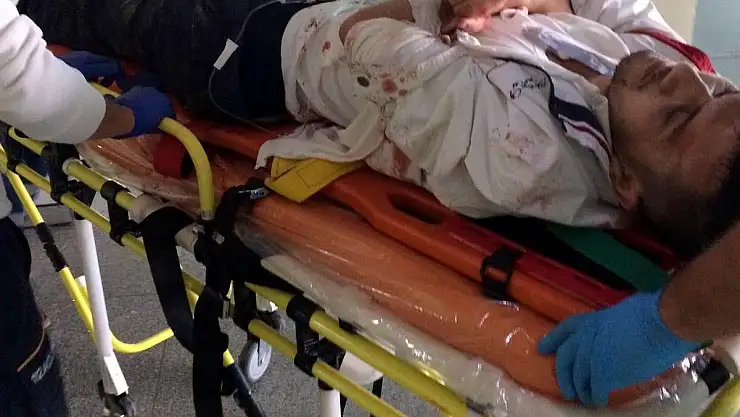 Kayseri'de silahlı kavga: 1 yaralı