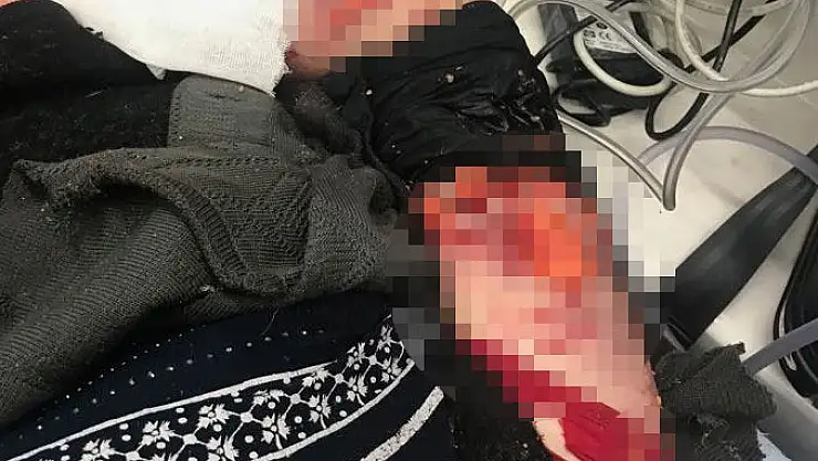 Kayseri'den sonra Kırşehir'de köpek saldırısı