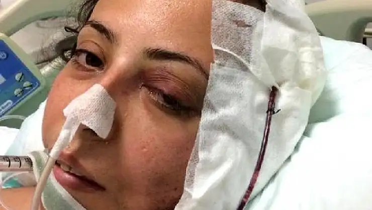 KIZININ GÖZÜ ÖNÜNDE VURULAN TUĞBA ANLAK YAŞAM SAVAŞINI KAYBETTİ