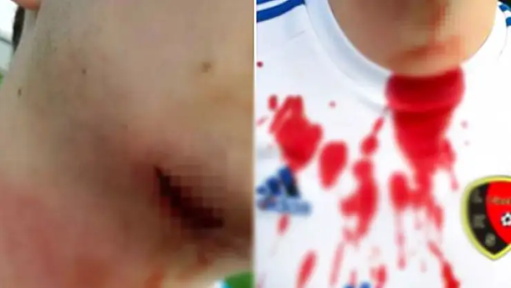 Konuk Takım Taraftarı, Sahaya Girerek Rakip Futbolcunun Boğazını Kesmeye Çalıştı