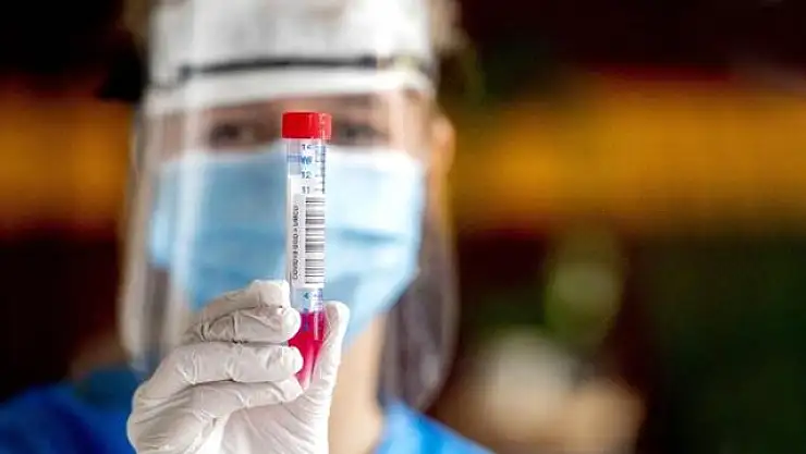 KORONA VİRÜS TEDAVİSİNDE KULLANILAN İLACIN FİYATI BELLİ OLDU