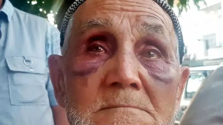 OĞLUNDAN KURTULMAK İÇİN CAMDAN ATLADI