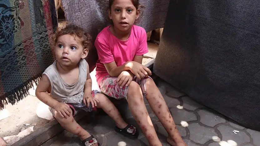 Gazze'de suçiçeği alarmı: Vakalar iki haftada 9 bini aştı