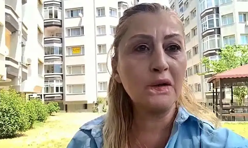 Estetik işlem sonrası dudağı çürüdü, 7 yıldır hukuk mücadelesi veriyor