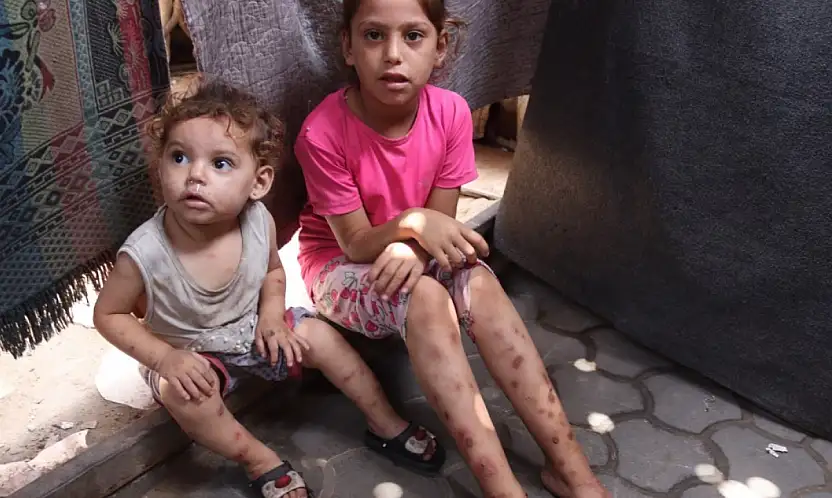 Gazze'de suçiçeği alarmı: Vakalar iki haftada 9 bini aştı